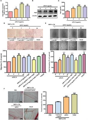 Apelin Promotes Endothelial Progenitor Cell Angiogenesis in Rheumatoid Arthritis Disease via the miR-525-5p/Angiopoietin-1 Pathway